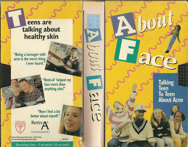 ABOUT FACE : TALKING TEEN TO TEEN ABOUT ACNE VHS COVER